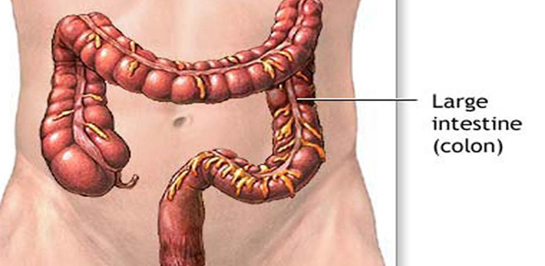 Bağırsak Üşütmesi Belirtileri ve Tedavisi